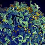 Генетики раскрыли ранее неизвестную опасность ВИЧ-инфекции