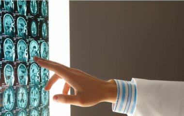 Названа робота, що призводить до недоумства