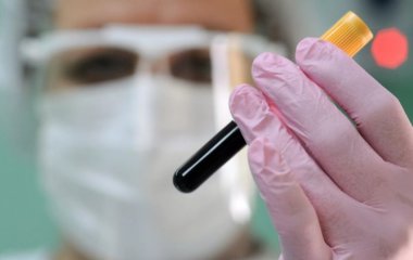 Імунолог розповів, як довго зберігаються антитіла до COVID-19 у молодих