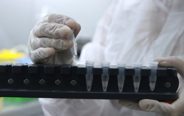 Вчені розповіли, як діятиме нові ліки від ВІЛ