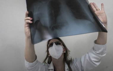 В Україні рентген та КТ пацієнти мають отримувати безоплатно: куди дзвонити, коли вимагають гроші