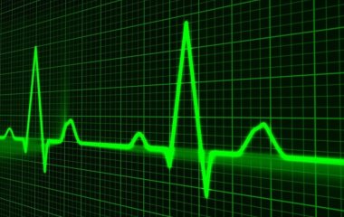 Кардіолог: Частота серцевого ритму вказує на тривалість життя людини