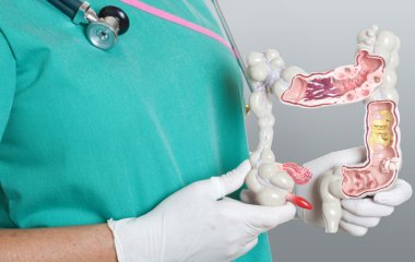 Симптоми раку кишечника: 3 ознаки, коли потрібно звернутися до лікаря