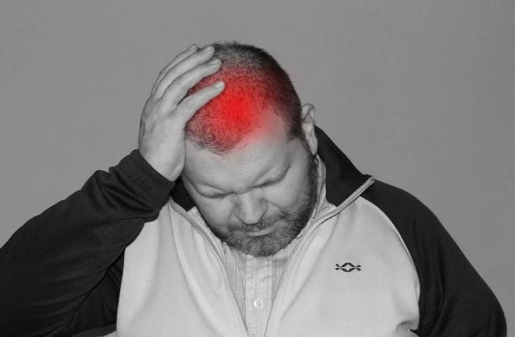 Лікар розповів, що таке метеопатія та як з нею боротися