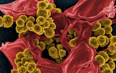 Вчені прояснили механізм захисту людських клітин від різних інфекцій