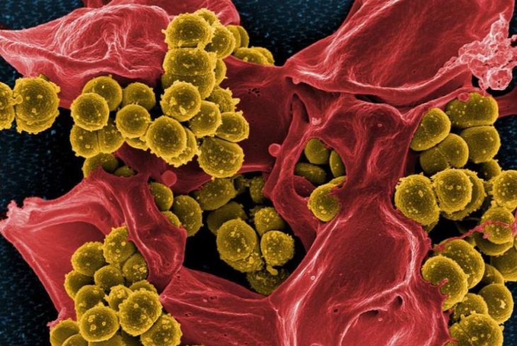 Вчені прояснили механізм захисту людських клітин від різних інфекцій