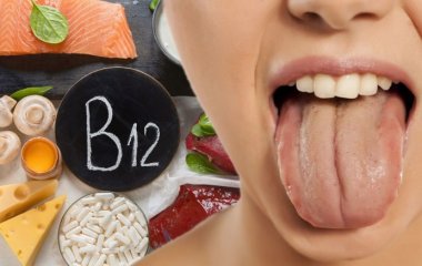 Ознакою дефіциту вітаміну B12 назвали незвичайний стан мови