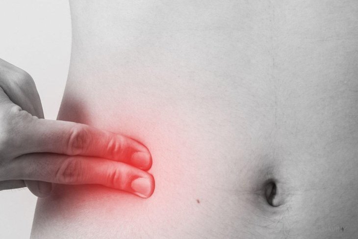 Врачи назвали пять предупреждающих признаков аппендицита