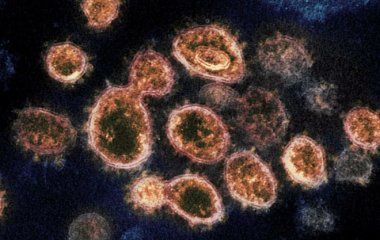 Вчені знайшли гени схильності до тяжкої форми COVID-19