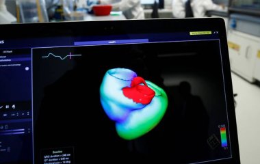 МРТ показала нові відмінності у роботі серця чоловіків та жінок