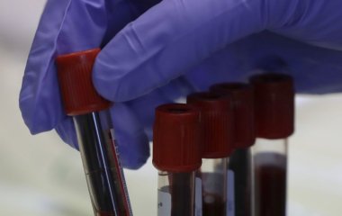 ПТСР руйнує не лише психіку: вчені знайшли сліди пережитої травми в звичайному аналізі крові