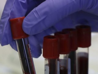 ПТСР руйнує не лише психіку: вчені знайшли сліди пережитої травми в звичайному аналізі крові