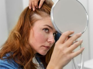 Нельзя злоупотреблять: какие витамины приводят к выпадению волос
