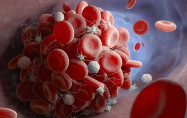 Ученые перечислили признаки, указывающие на риск тромбоза после вакцинации