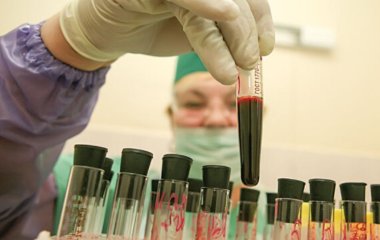 Визначено найнебезпечнішу групу крові: кому слід побоюватися за життя