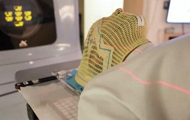 Онколог назвала симптоми раку в області голови та шиї