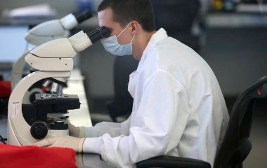 Біологи відкрили ген, пов'язаний із появою вугрів на шкірі
