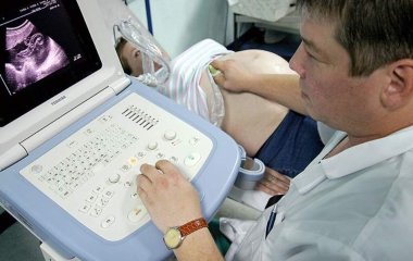 Гінеколог назвала можливі причини невдалих спроб завести дитину