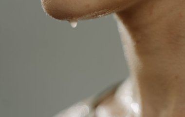 Сильная потливость: как этому помочь