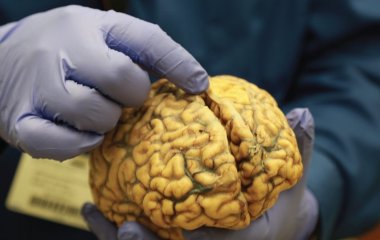 Как сделать мозг помоложе. Невролог назвала три принципа