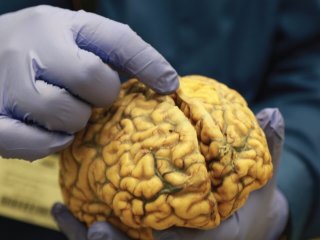 Как сделать мозг помоложе. Невролог назвала три принципа