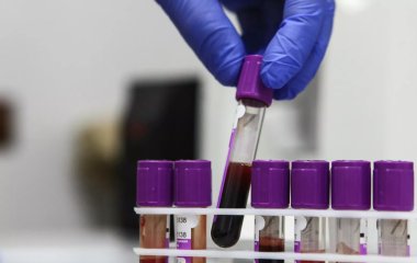 Вчені визначили специфіку імунної відповіді на коронавірус