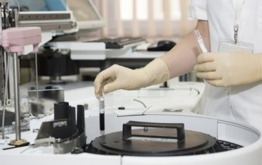 Вчені знайшли новий спосіб лікування артриту та склерозу