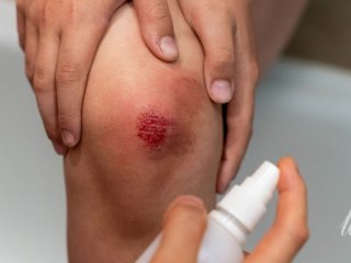 Звичайний поріз може стати смертельно небезпечним: які симптоми не можна ігнорувати