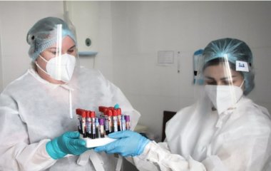 Вірусолог назвав спосіб переконатися у повному одужанні від COVID-19