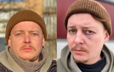 Известного украинского актера избили в Днепре