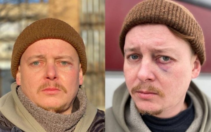 Известного украинского актера избили в Днепре