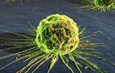Чому виникає рак — вчені назвали причини