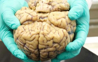 Ученые выяснили, почему стареет человеческий мозг