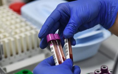 Названо найменш схильну до раку групу крові