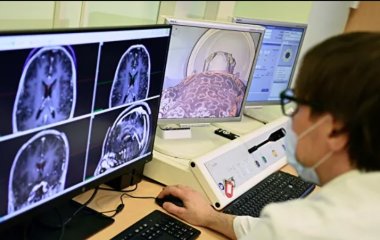 Розроблено метод візуальної оцінки старіння мозку