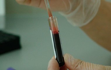Вчені назвали симптом раку крові, який може виявлятися вночі