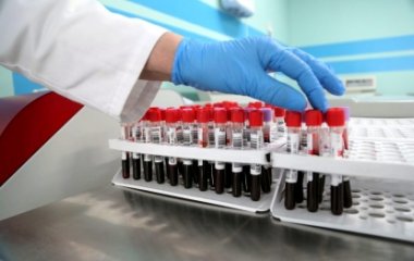 Біолог розкрила небезпеку вживання ягід
