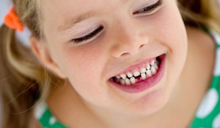 Удаление молочных зубов у детей: советы родителям
