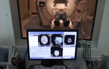 Вчені розповіли про здатність алкоголю ушкоджувати мозок