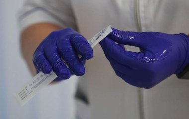 Лікар розповів про порушення у роботі мозку після COVID-19