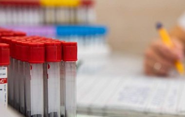 Лікар назвала головні ознаки анемії