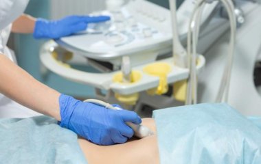 Нутриціолог назвала продукт, що відновлює роботу кишечника.