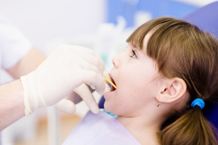 Как предотвратить кариес: 5 советов, которые сохранят ваши зубы здоровыми