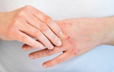 Лікар розповіла, що може ховатися за 
