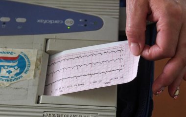 Лікар розповів про способи розпізнати інфаркт