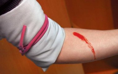 Чого не можна робити при венозній кровотечі