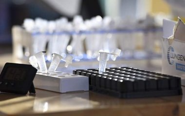 Вірусолог назвав особливість антитіл до «Омікрону»