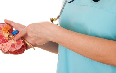 Лікарі розповіли, як швидко розпізнати каміння у нирках