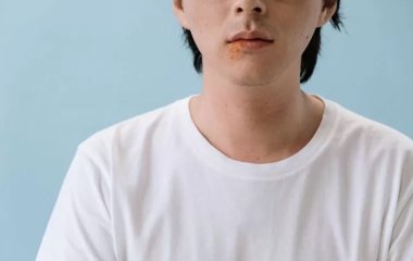 Як позбутися герпесу за допомогою народних засобів за один день