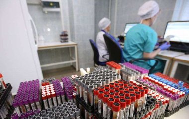 Вчені з'ясували, яка аномальна патологія веде до смерті при коронавірусі